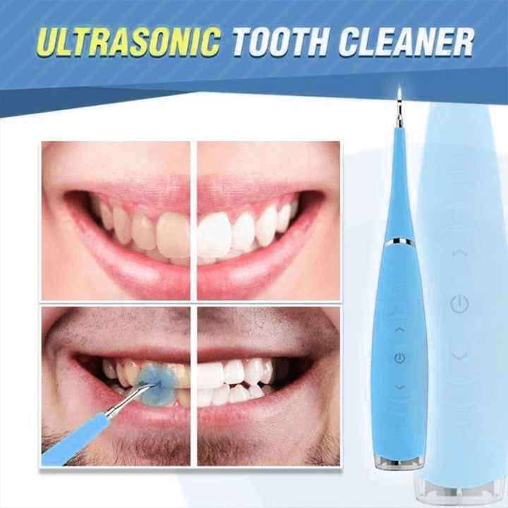 OralCare Ultrasonic Teeth Cleaner (New Colors 2022 Edition)