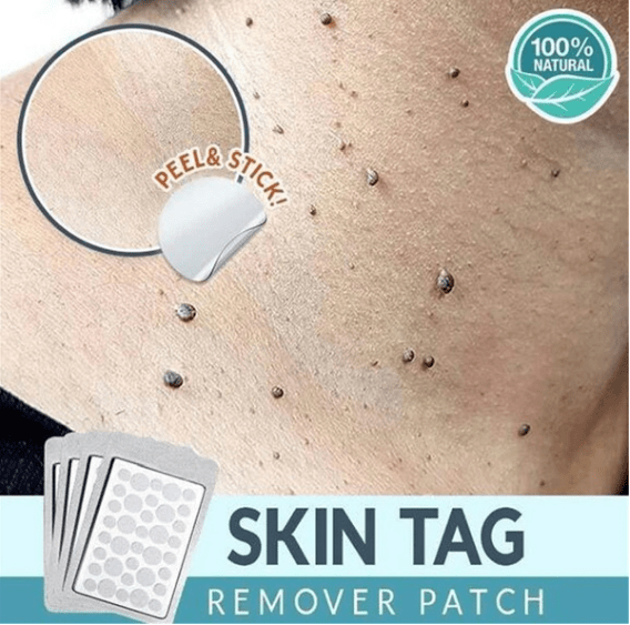 Skin Tag Removal Patches