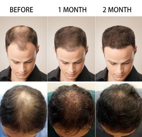 OriginPro™ Anti-Hair Loss Rice Shampoo Bar