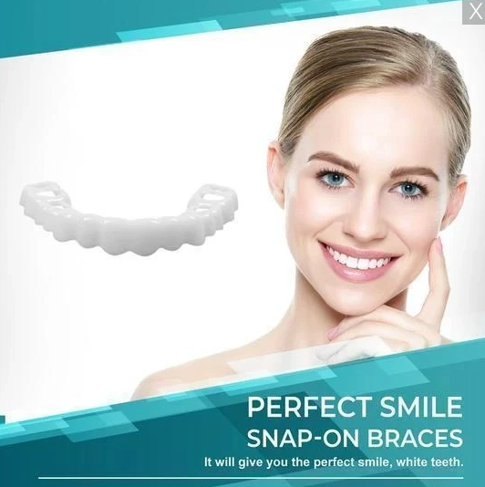 PerfectSmile™ Snap-On Braces