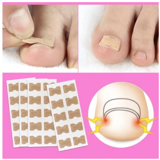 Painless Toenail Patch