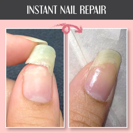 Instant Nail Repair Protect Gel