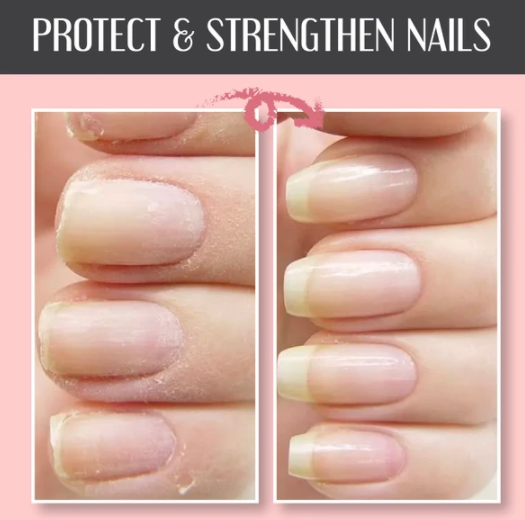 Instant Nail Repair Protect Gel